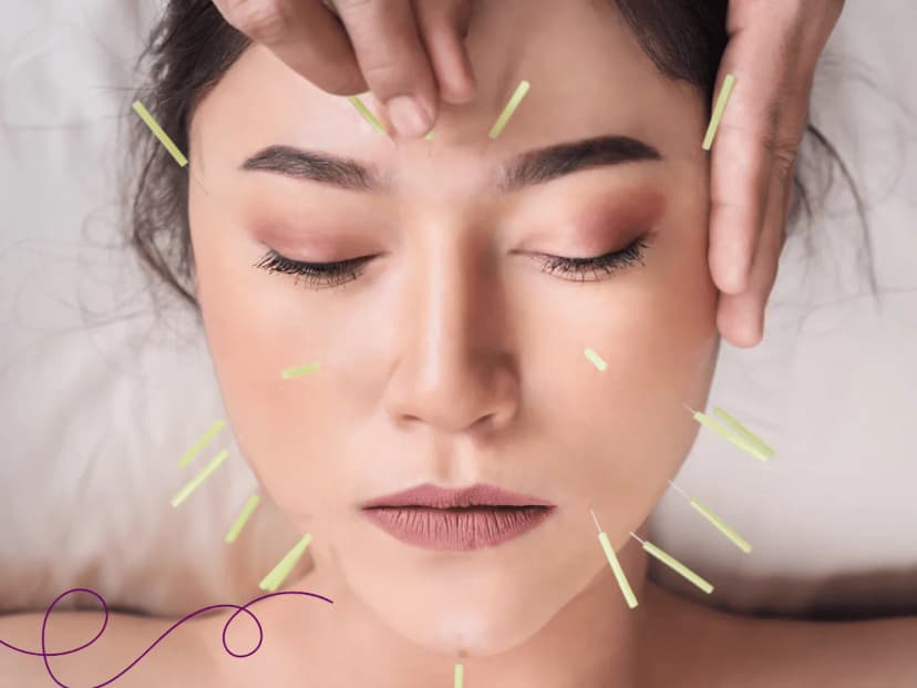 ¿Agujas en menopausia?